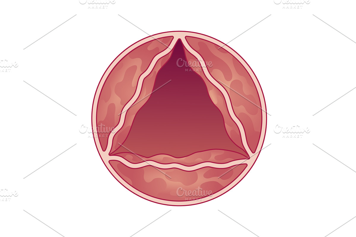Medical illustration shows, an Object Illustration by Things for designers