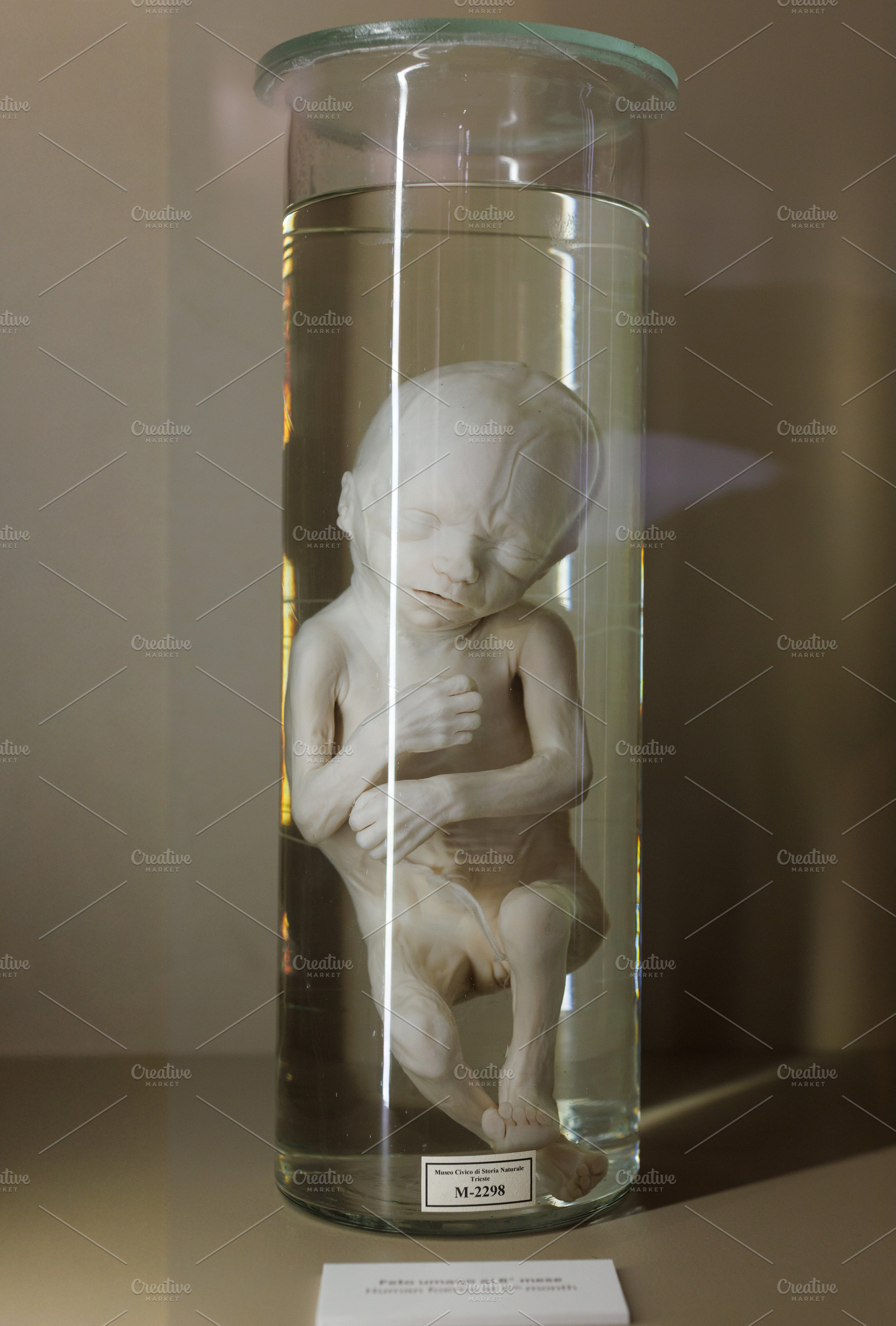 Human fetus 8 th month in glass container with formalin, a School & Education Photo by Bepslabor