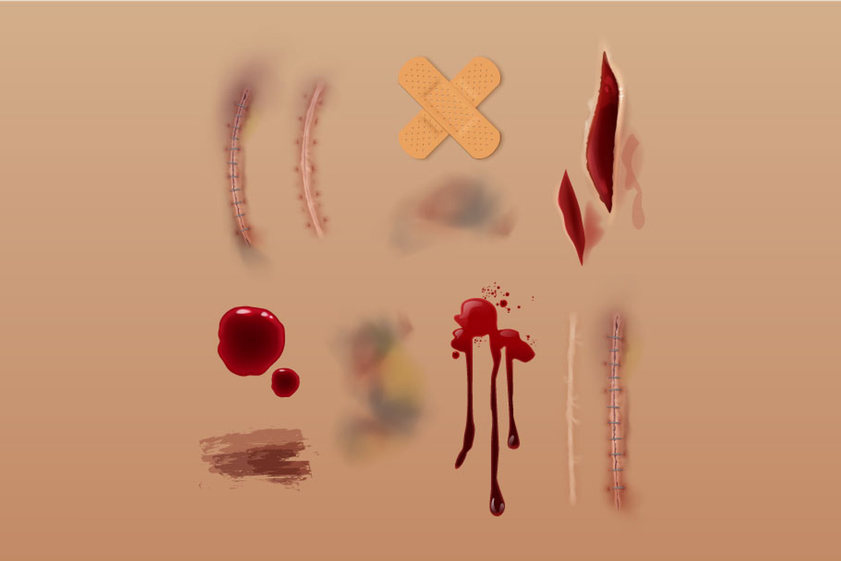 Scars Set, a Healthcare Illustration by Zonda (Photo 2 of 13)