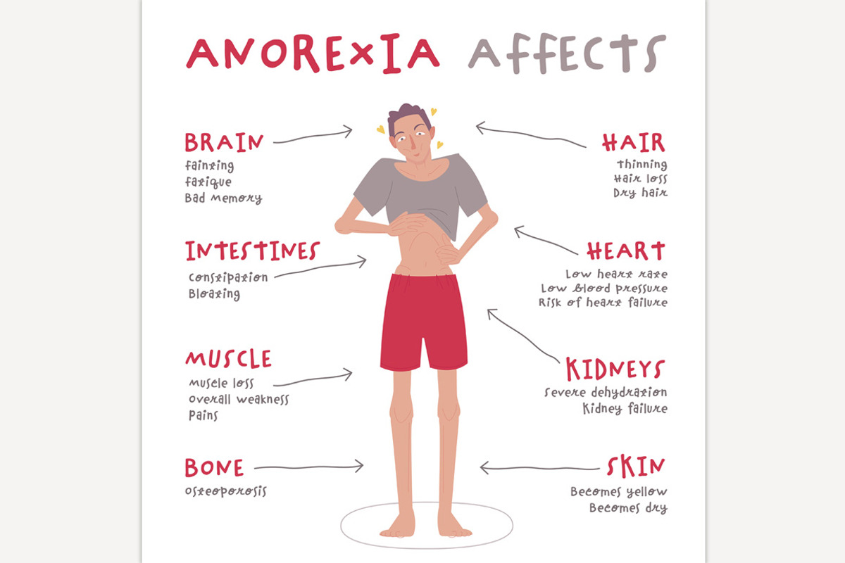 Eating disorder in men and boys., a Healthcare Illustration by Anna's Shop