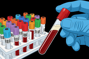 doctor hand taking a blood sample, a Health & Medical Photo by angellodeco