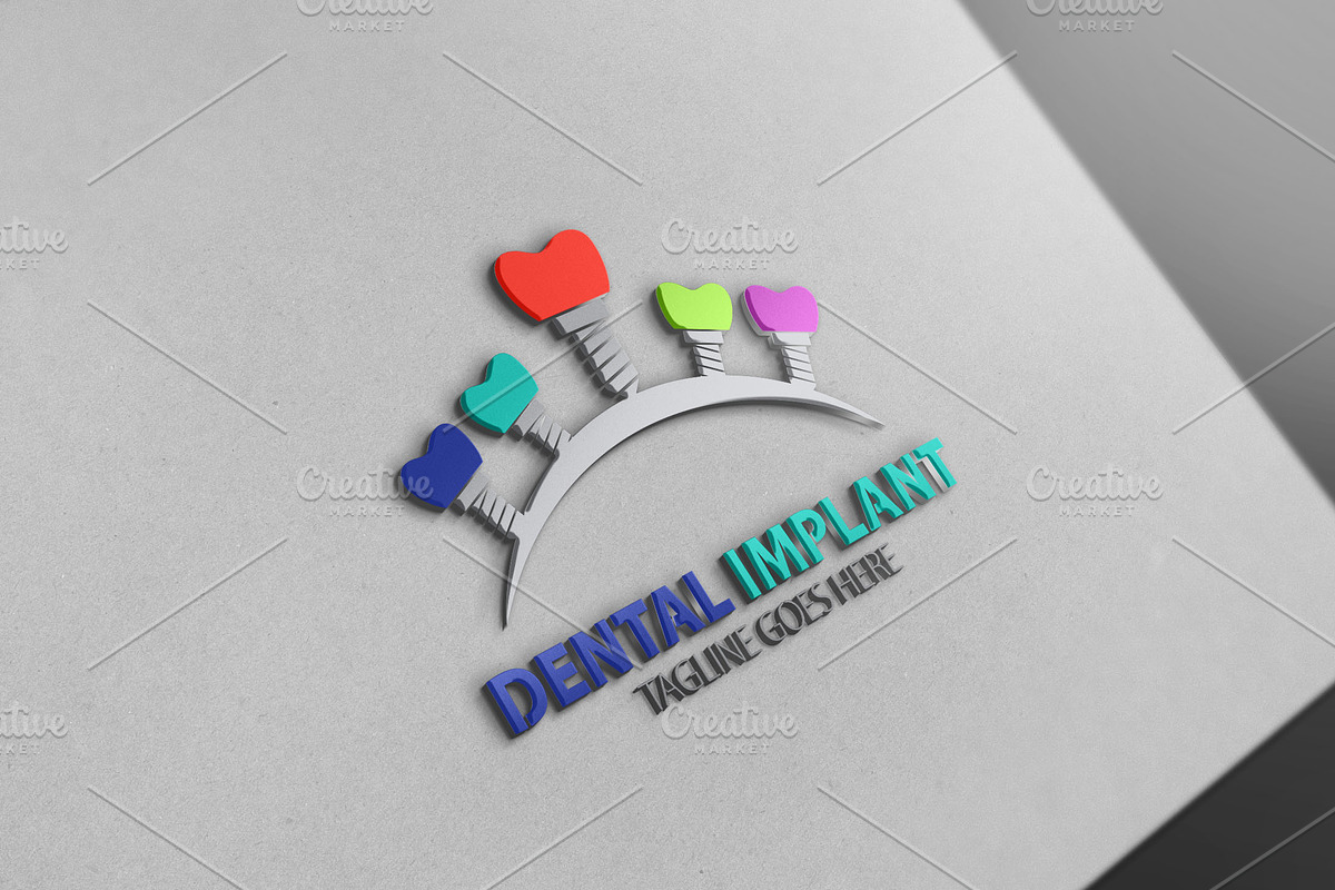 The Best/Dental Implant Logo3, a Branding & Logo Template by Josuf Media (Photo 2 of 3)
