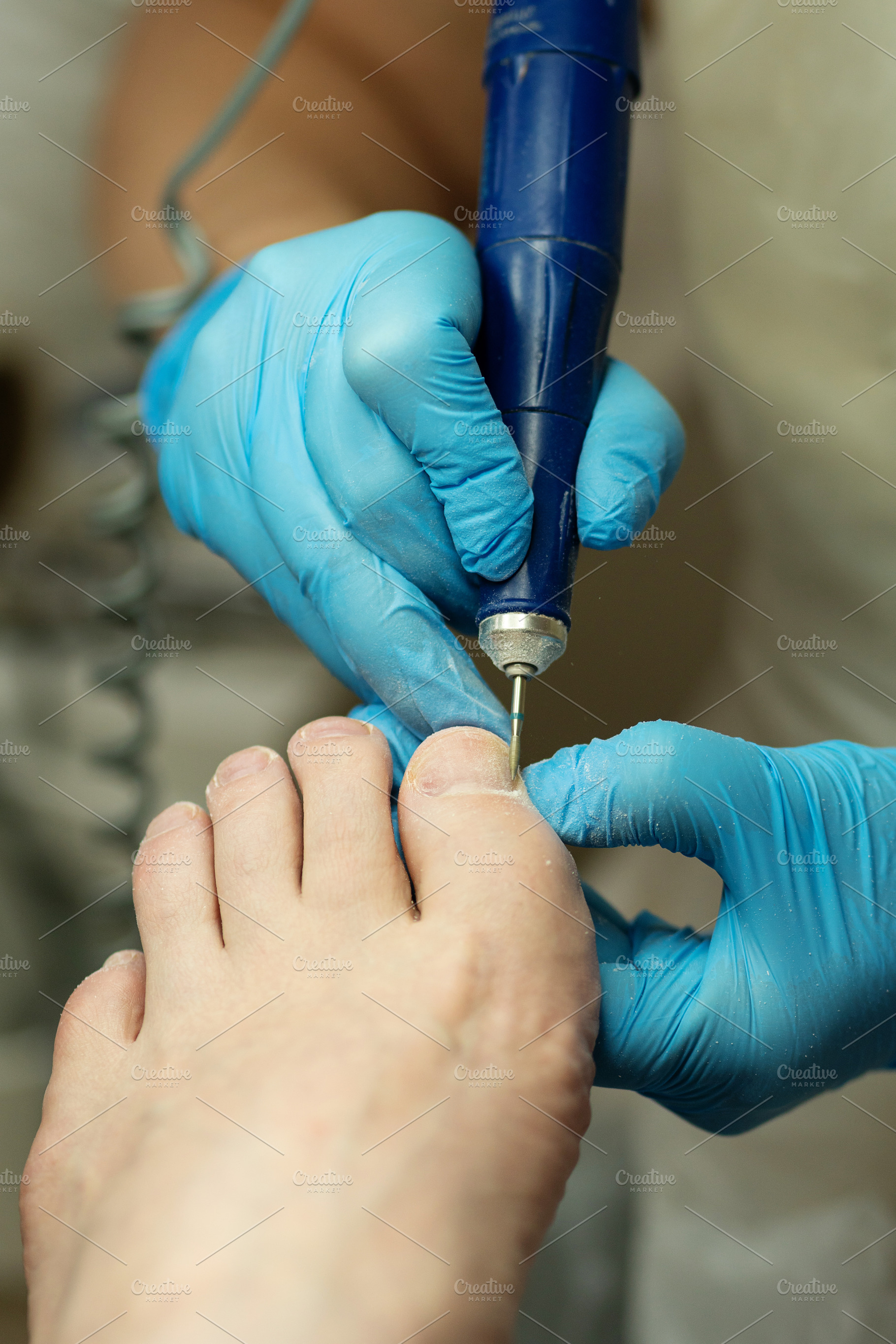 Gloved technician works on toenails, a Health & Medical Photo by Elena Vagengeim