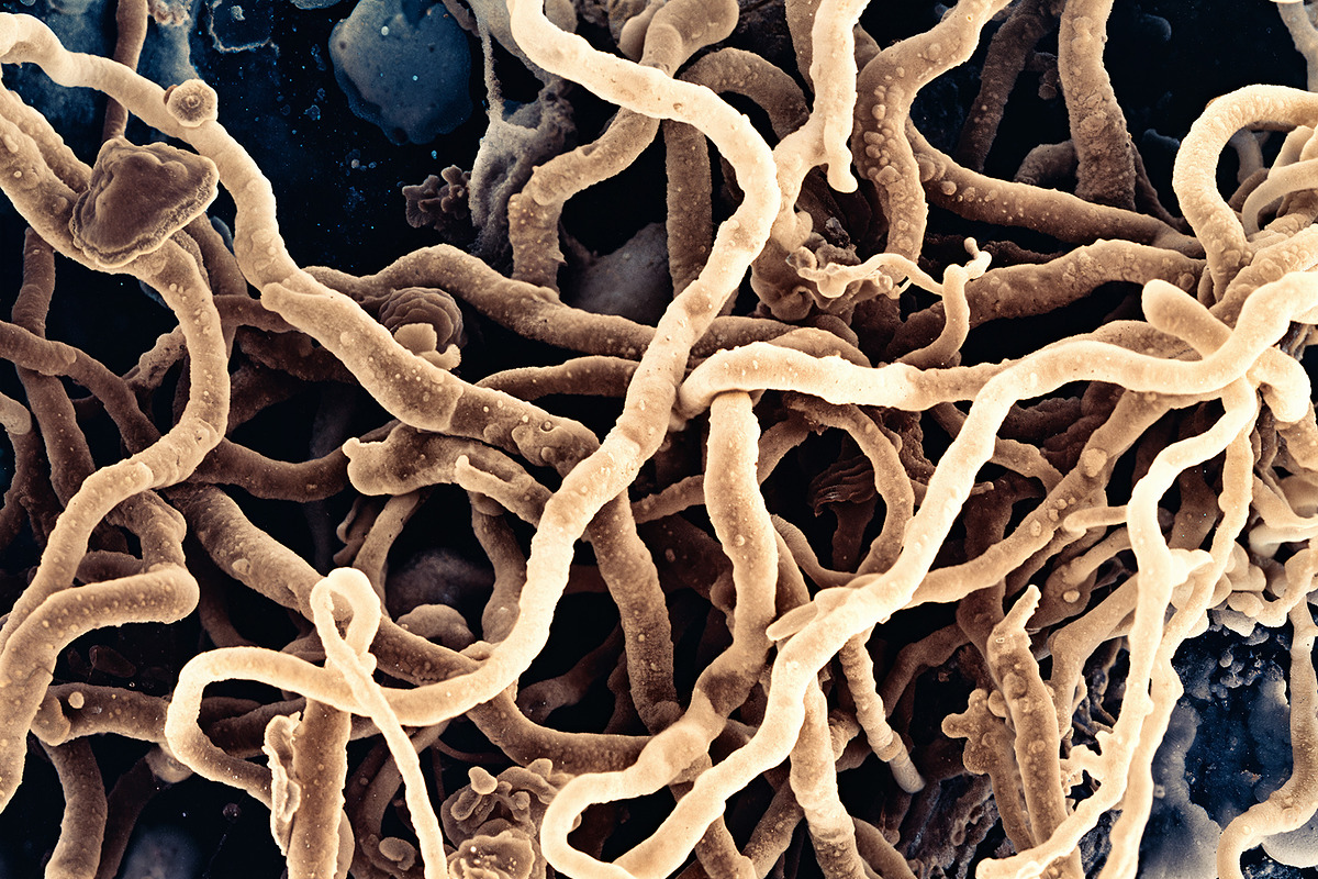 72 Microscopic Fungi Backgrounds, a Background Graphic by h.utomo (Photo 3 of 72)