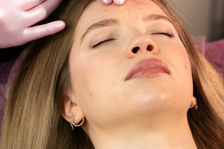 Woman undergoing non-surgical facial