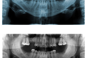 Panoramic dental X-Ray images, a Health & Medical Photo by Vector Tradition