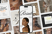 Skincare CANVA Beauty Templates, a Social Media Template by Xenié Creative (Thumbnail 10 of 10)