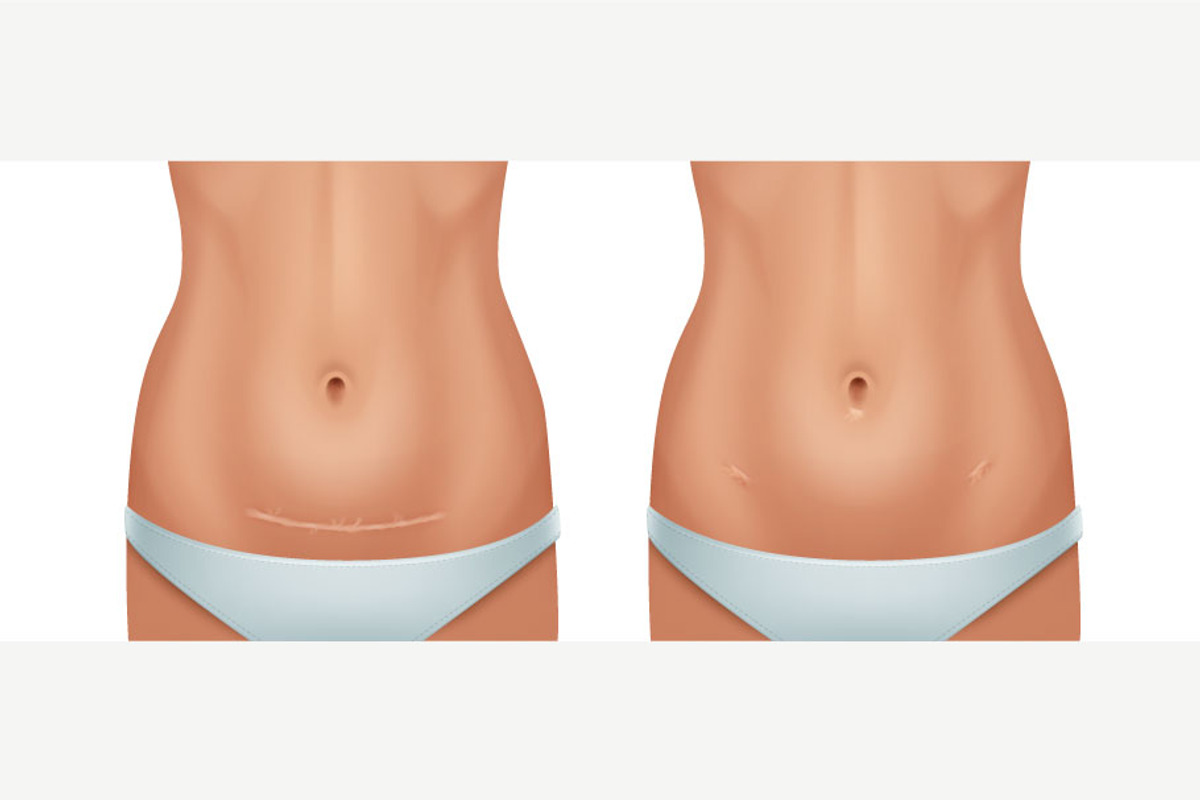 Scars Set, a Healthcare Illustration by Zonda (Photo 7 of 13)