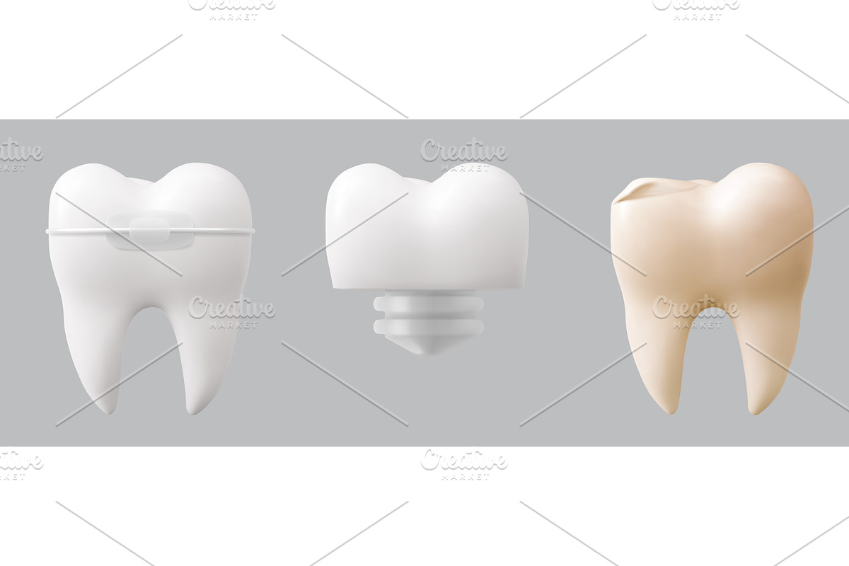 Realistic tooth collection, an Object Illustration by art PVP - market