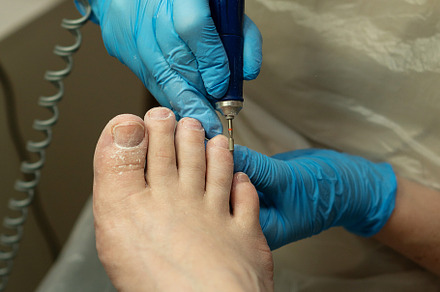 Podiatrist performs dry pedicure