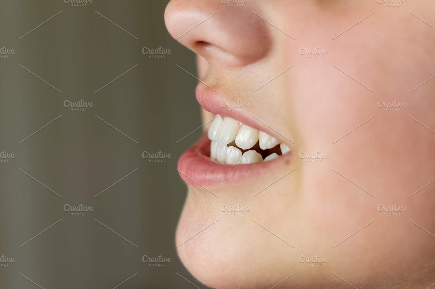 Malocclusion or child's teeth, a Health & Medical Photo by Nastya_Velko