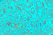20 turquoise textures 64 Megapixel, a Texture Graphic by tkdesign (Thumbnail 6 of 20)