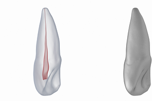 Upper Central Incisor With Pulp