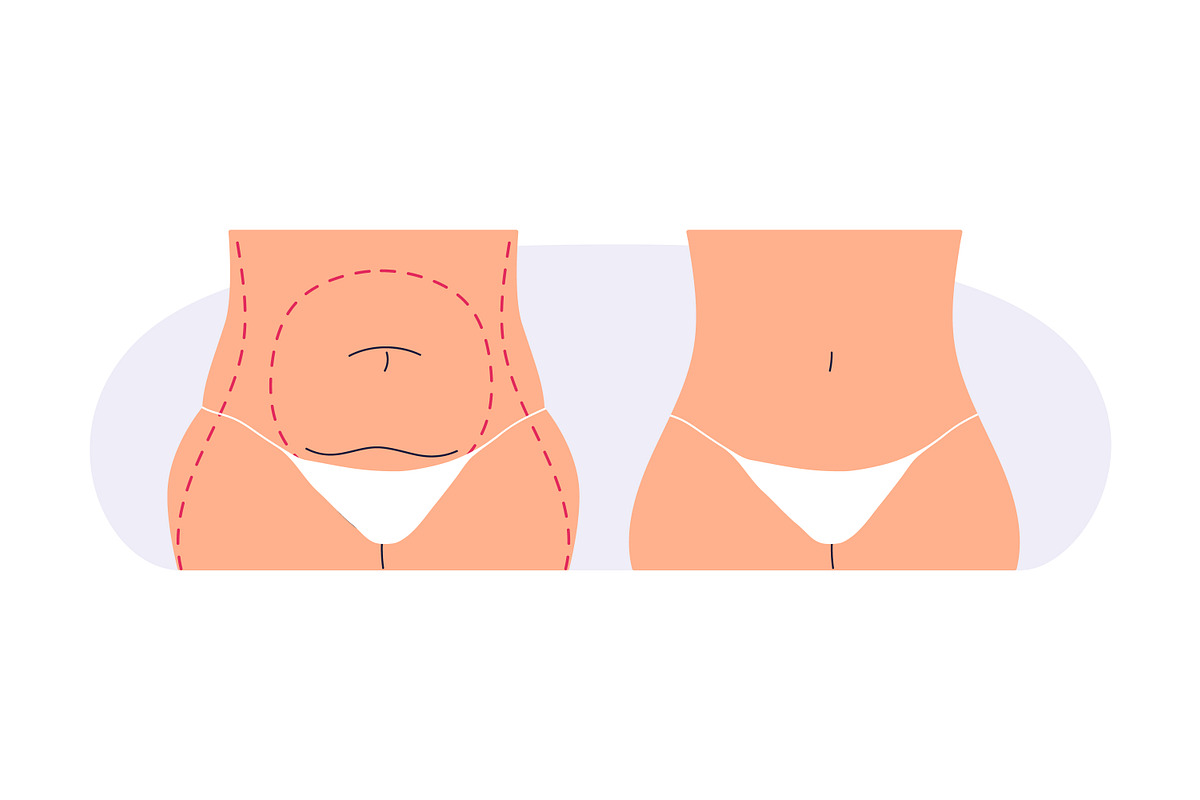 Plastic surgery in beauty clinic set, a Healthcare Illustration by Good Studio (Photo 4 of 12)