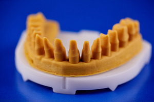 3D printed dental jaw model with prepared stumps for crowns and bridges., a Health & Medical Photo by Rohan Photography
