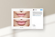 Aesthetic Nurse Injector templates, a Social Media Template by LiliesandBerries (Thumbnail 20 of 23)