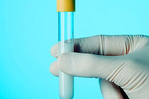 healthcare worker with a test tube with some semen, a Photo by Nito