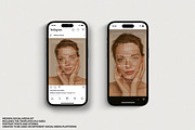 Medpsa and Injector Instagram Kit, a Social Media Template by Wildnun Studio (Thumbnail 2 of 20)