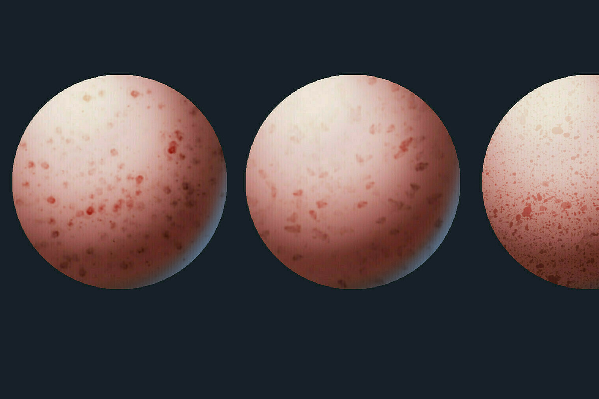Freckles Brush Pack, a Brushes & More by vurdembrushes (Photo 4 of 4)