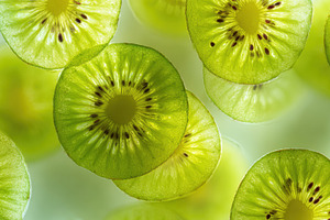 Kiwi slices create a vibrant display, a Photo by Beautiful things