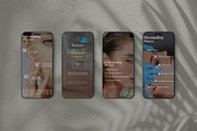 Microneedling Instagram Template, a Social Media Template by Terraa Studio Design (Thumbnail 2 of 6)