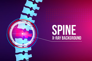 Spine x-ray, pain neck, disk.