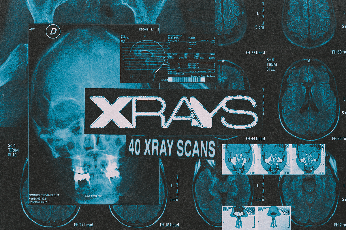 X-Rays Image Pack, a Health & Medical Photo by Design syndrome (Photo 1 of 5)