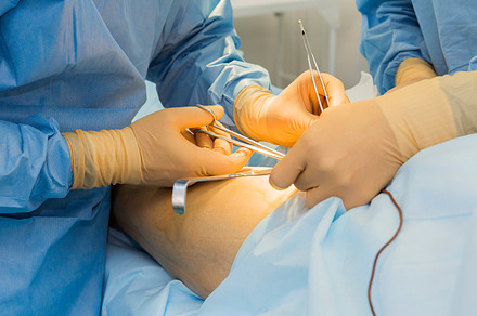 In The Operating Room preview 6