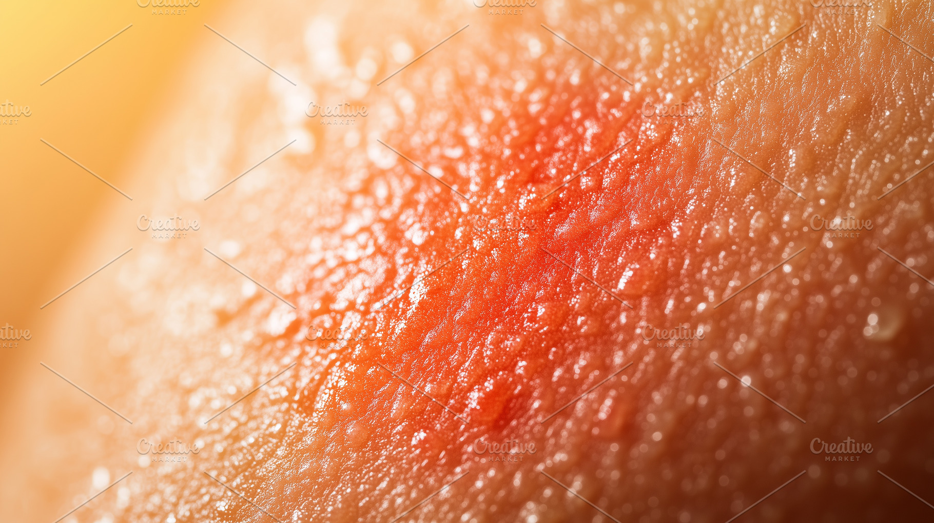 Irritated, sunburned human skin, a Health & Medical Photo by MistyDay