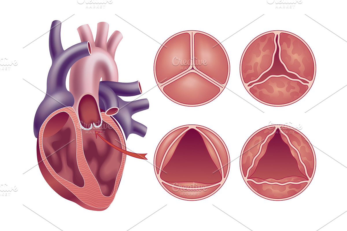 Medical illustration shows the, an Object Illustration by Things for designers