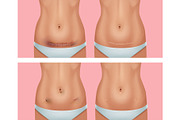 Scars Set, a Healthcare Illustration by Zonda (Thumbnail 8 of 13)