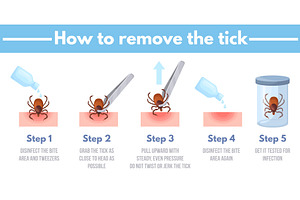 Tick removal. How to remove ticks, a Healthcare Illustration by Stock-Smart-Start