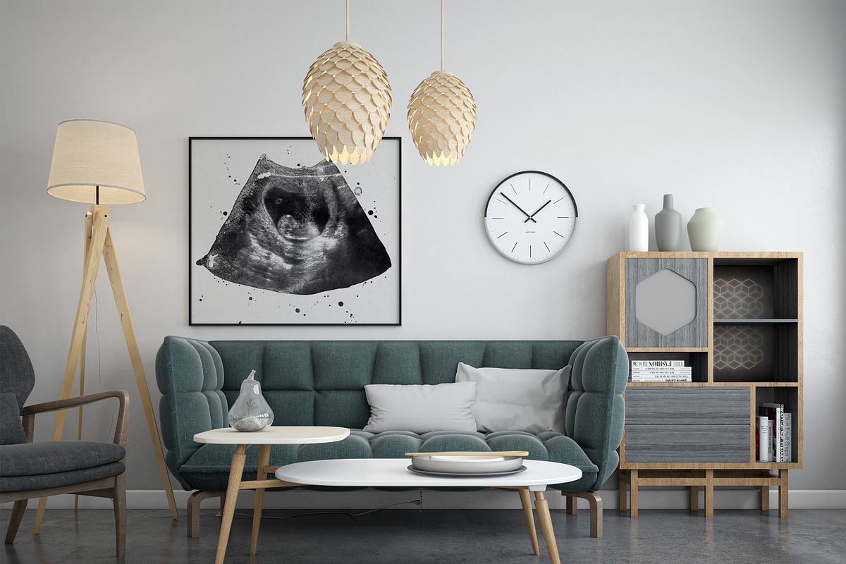Watercolor ultrasound photomasks, a Layer Style Add-On by BrownLeopard (Photo 10 of 11)