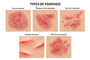 Psoriasis types. Skin hives, derma | Background Graphics ~ Creative Market