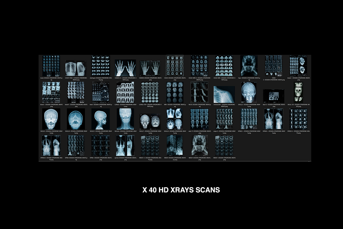 X-Rays Image Pack, a Health & Medical Photo by Design syndrome (Photo 4 of 5)