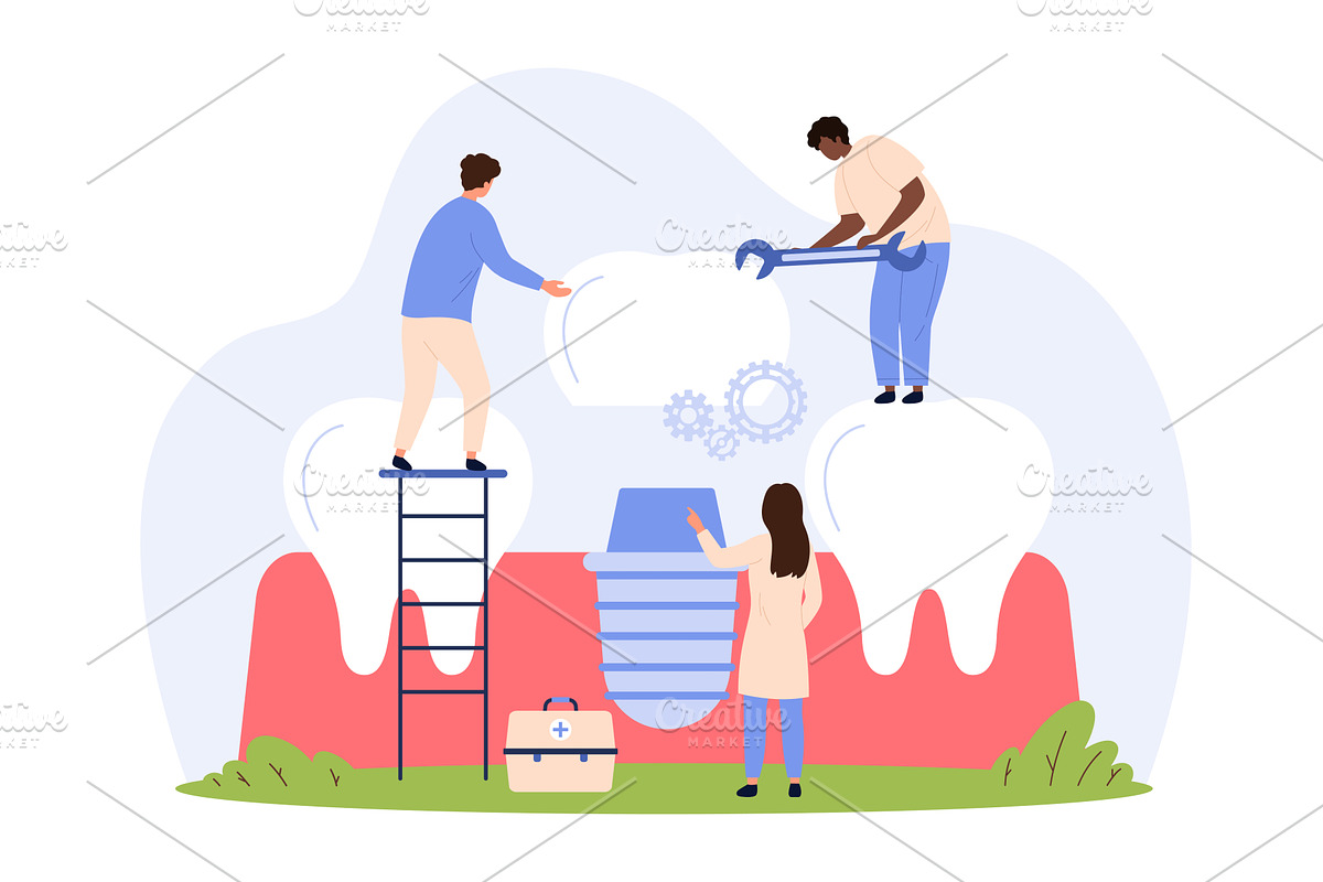 Dental implant procedure at, an Object Illustration by Flashvector