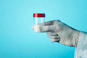 man with a sterile container with semen, a Photo by Nito