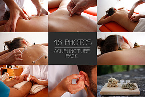 16 Acupuncture Photos
