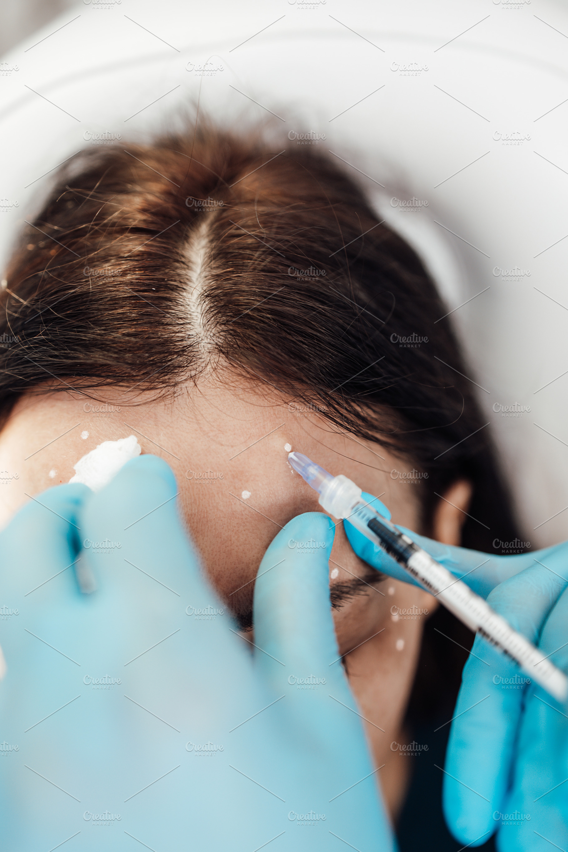 Real beauty treatment with botox stock photo containing beauty and botox, a Beauty & Fashion Photo by REDDOT Studio