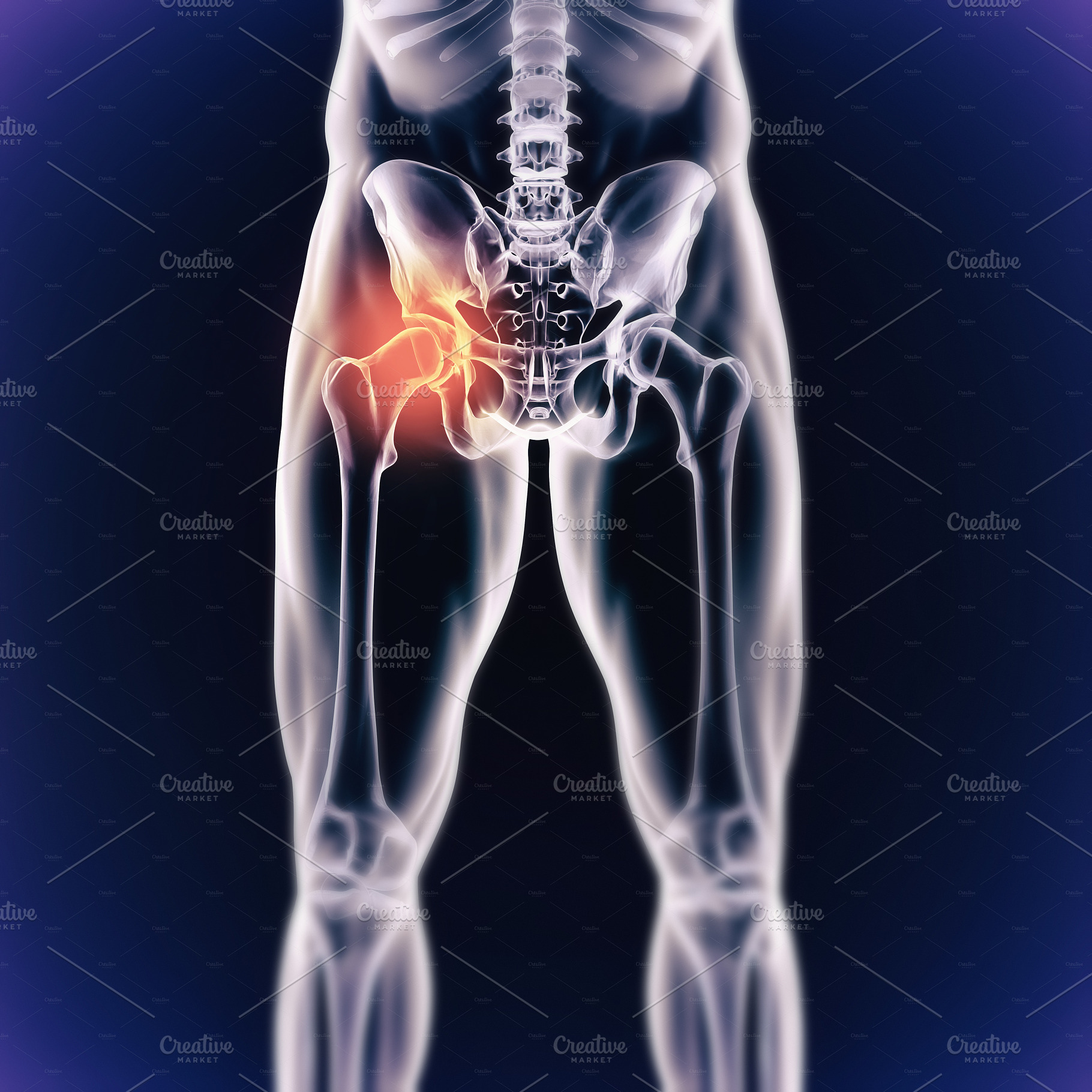 When inflammation strikes!, a Photo by Peopleimages.com