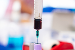 Close up blood sample for diagnosis and treatment patient in the, a Health & Medical Photo by Casanowe-studio