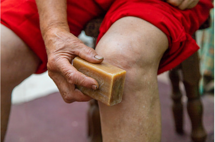 Grandmother treats her knees with, a Health & Medical Photo by yanadjana