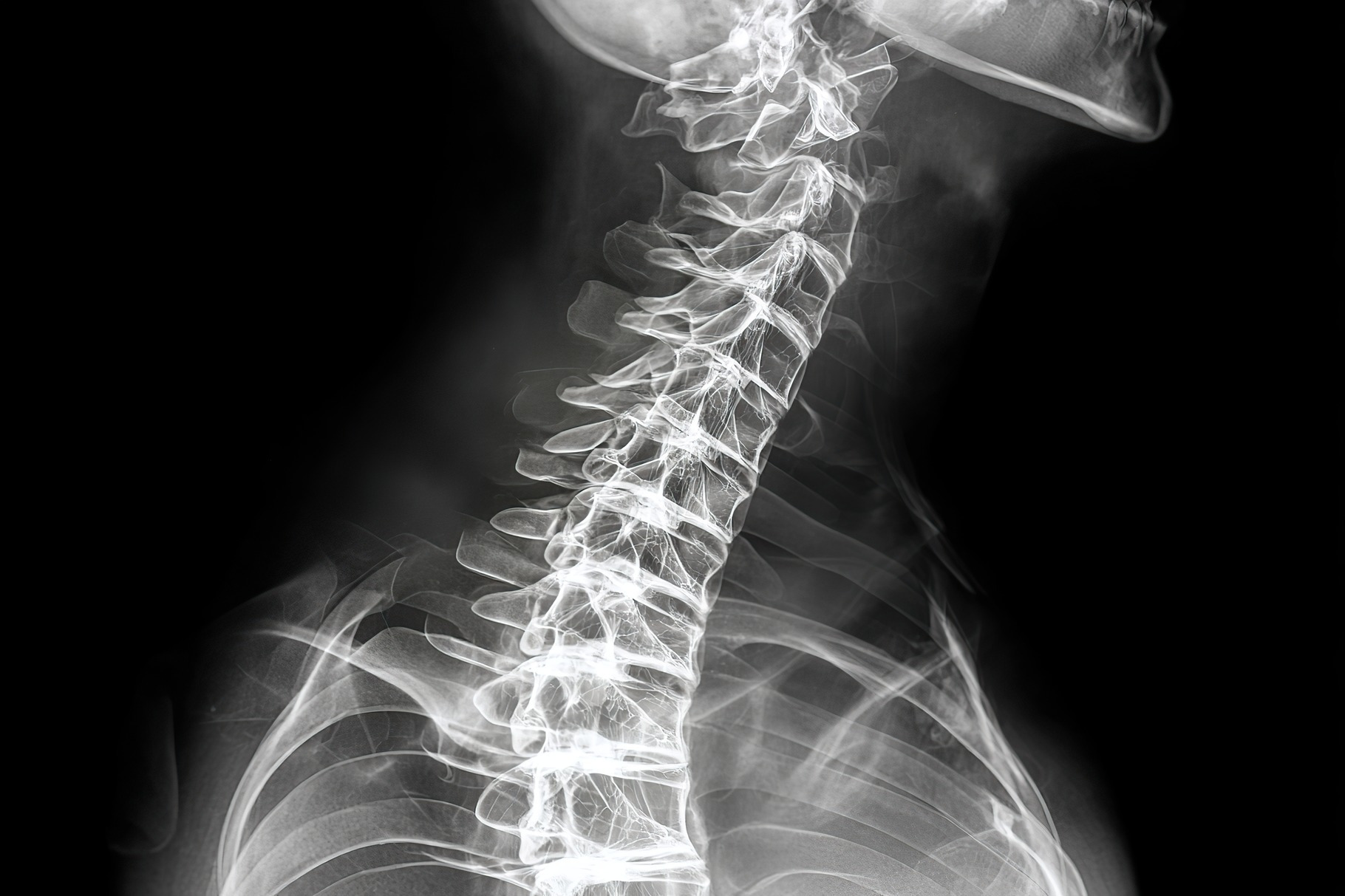 Detailed view of human spinal column highlighting vertebrae structure ...