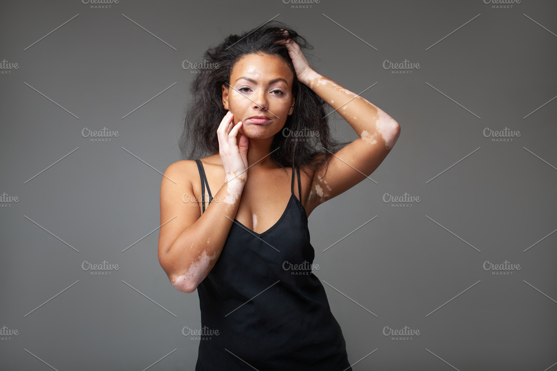 Confident fashion model with vitiligo with hand in hair in studio, a Photo by andreonegin market