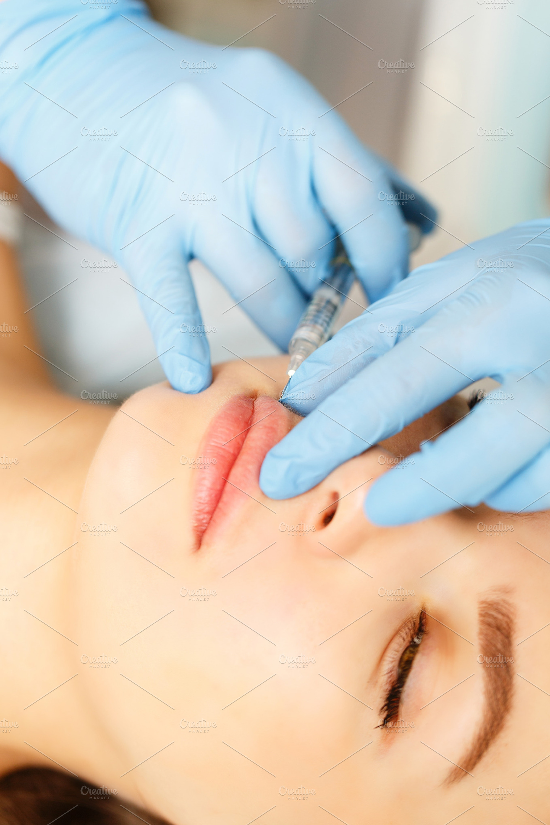 Subcutaneous injection lips featuring background, medical, and woman, a Health & Medical Photo by Elena Vagengeim