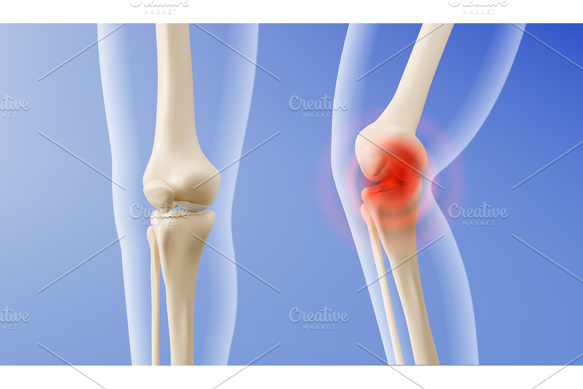 3d medical knee- healthy joint, an Object Illustration by art PVP - market