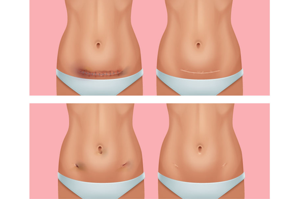 Scars Set, a Healthcare Illustration by Zonda (Photo 8 of 13)