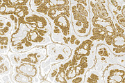 Marble textures 8000 x 8000 px, a Texture Graphic by tkdesign (Thumbnail 21 of 21)