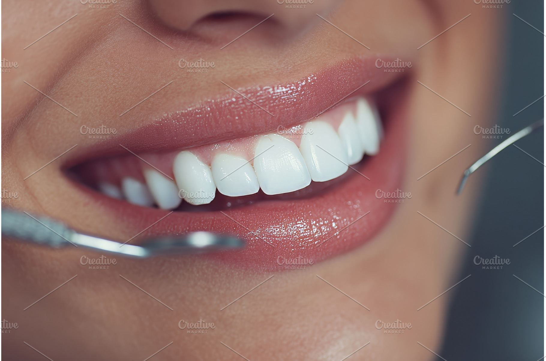 Close-up shot of a female's teeth, a Health & Medical Photo by ZinetroN