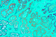 20 turquoise textures 64 Megapixel, a Texture Graphic by tkdesign (Thumbnail 4 of 20)